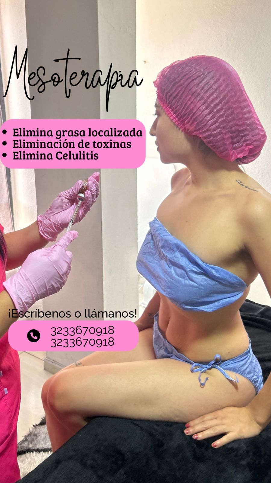 Mesoterapia